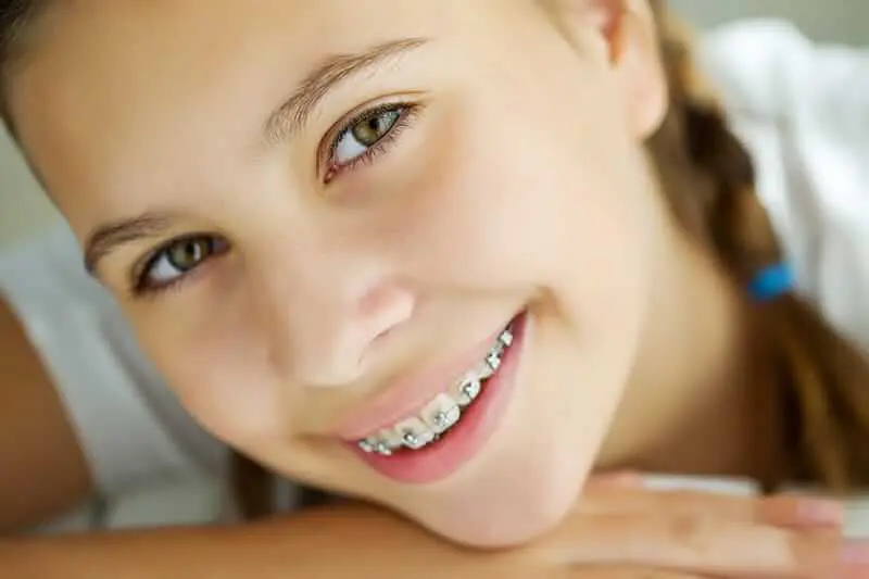 Healthy Gums And Teeth With Traditional Braces